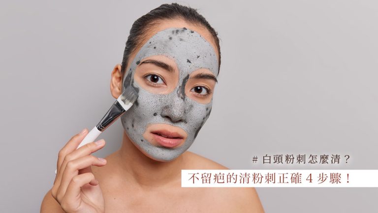不留疤的清粉刺正確4步驟！白頭粉刺怎麼清？