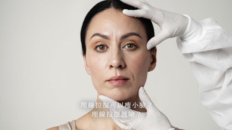 埋線拉提可以瘦小臉？埋線拉提風險？