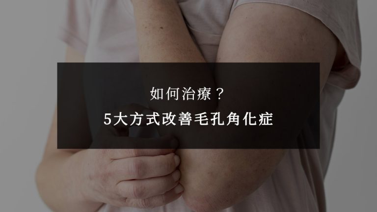 如何治療？5大方式改善毛孔角化症