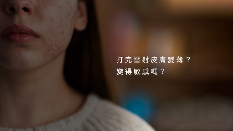 打完雷射皮膚變薄？變得敏感嗎？