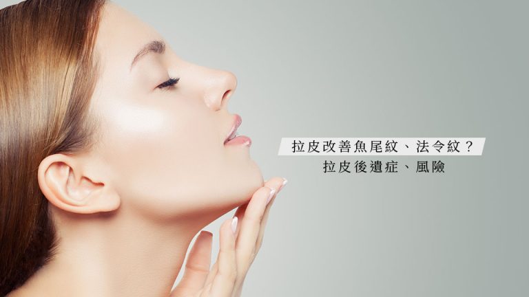 拉皮可以改善魚尾紋、法令紋？拉皮後遺症、風險