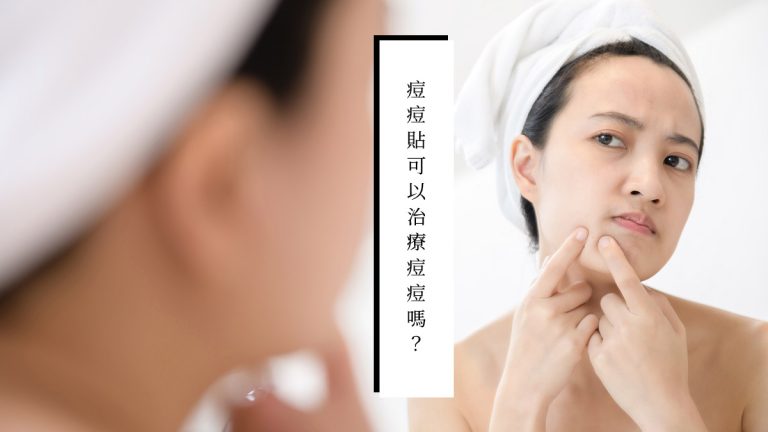 痘痘貼可以治療痘痘嗎？