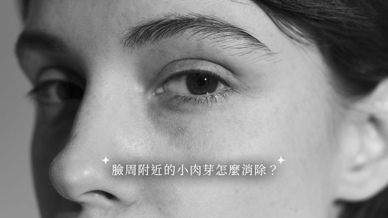 臉周附近的小肉芽怎麼消除？