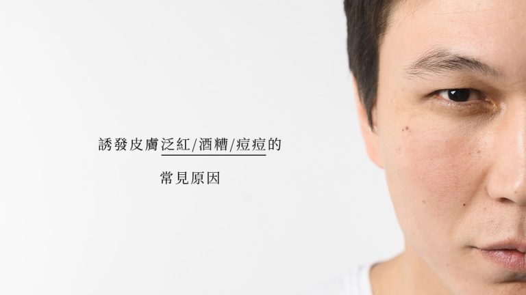 誘發皮膚泛紅、酒糟、痘痘的常見原因