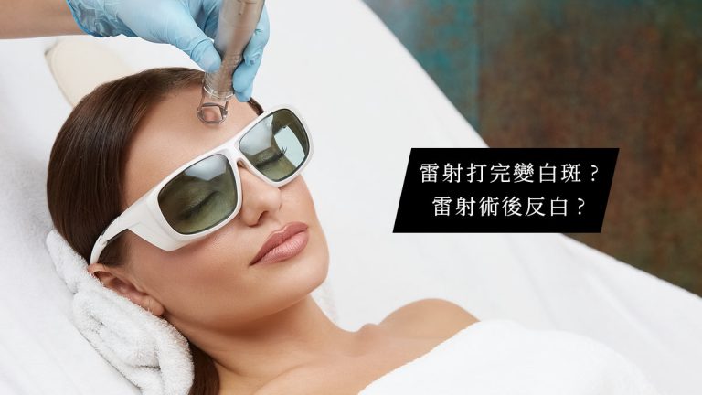 雷射打完變白斑?雷射術後反白?