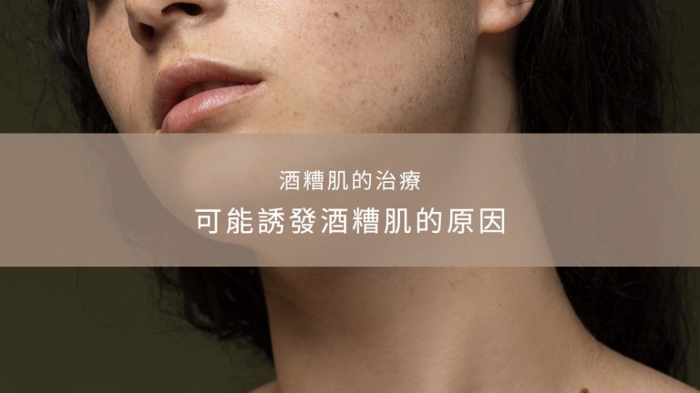 可能誘發酒糟肌的原因｜酒糟肌的治療