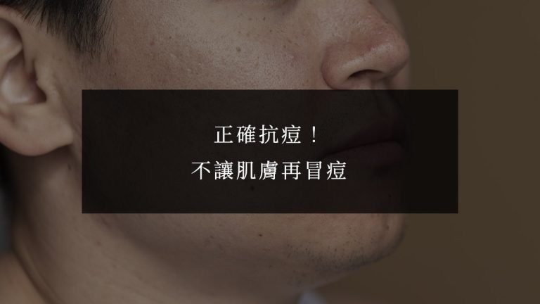 正確抗痘！不讓肌膚再冒痘