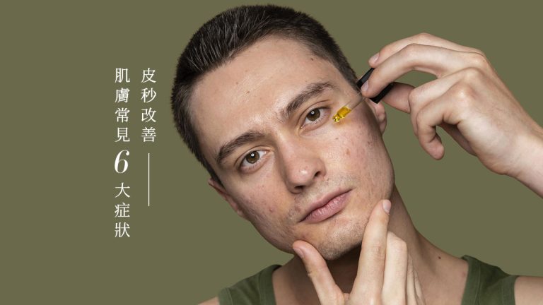 皮秒改善肌膚常見6大症狀