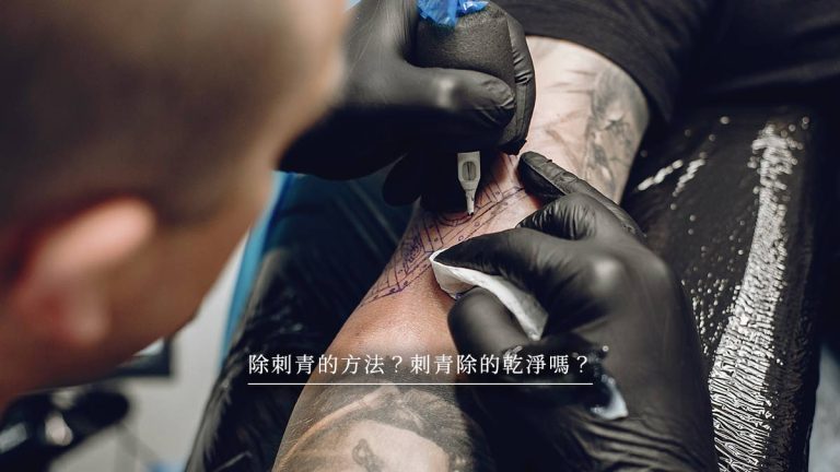 除刺青的方法？刺青除的乾淨嗎？