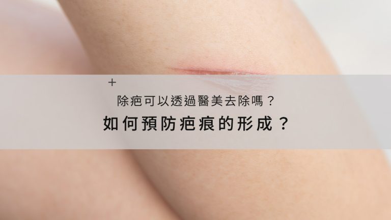 如何預防疤痕的形成？除疤可以透過醫美去除嗎？