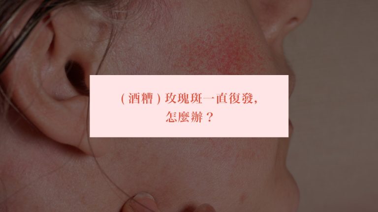 （酒糟）玫瑰斑一直復發，怎麼辦？